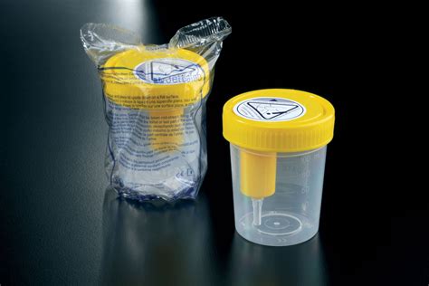 urine sample bottles nhs